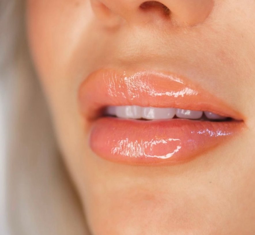 Close-up of glossy, natural-toned lips and part of nose and chin